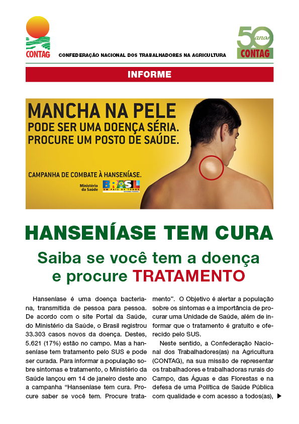Hanseníase: como detectar e tratar a doença - Prefeitura do Paulista -  Cuidando da cidade, trabalhando pra você.
